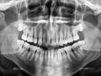 Radiografia panorâmica